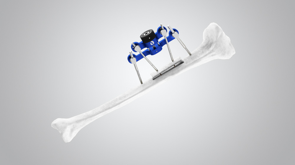 TrueLok Elevate